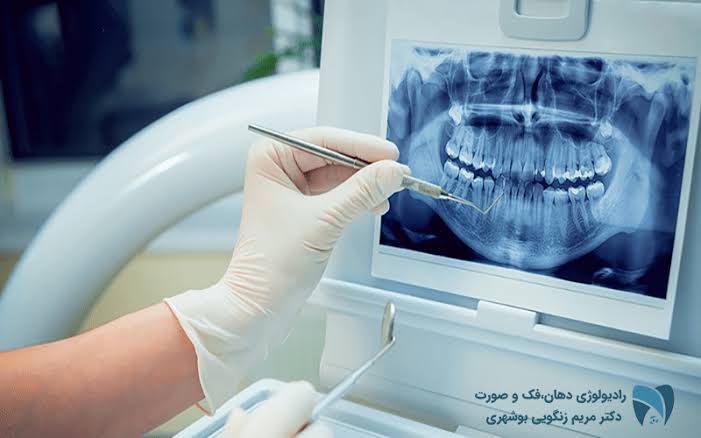 رادیولوژی تخصصی دهان و دندان